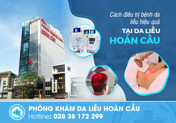 Phòng Khám Da Liễu Hoàn Cầu - Nơi điều trị mụn cóc hiệu quả