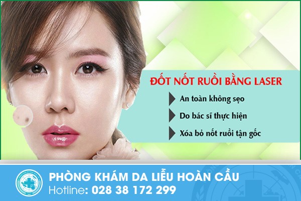 Xóa nốt ruồi an toàn bằng phương pháp Lazer tại Phòng Khám Da Liễu Hoàn Cầu