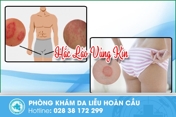 hắc lào vùng kín