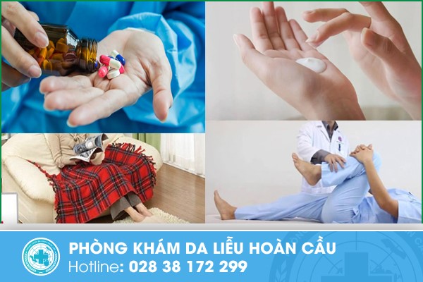 Những phương pháp hỗ trợ chữa trị bệnh xơ cứng bì