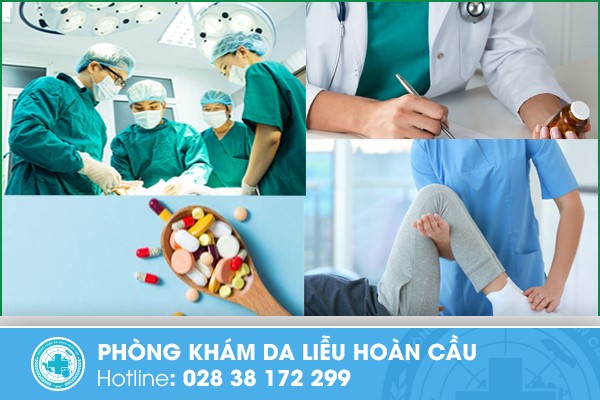 Các phương pháp trị bệnh xơ cứng bì