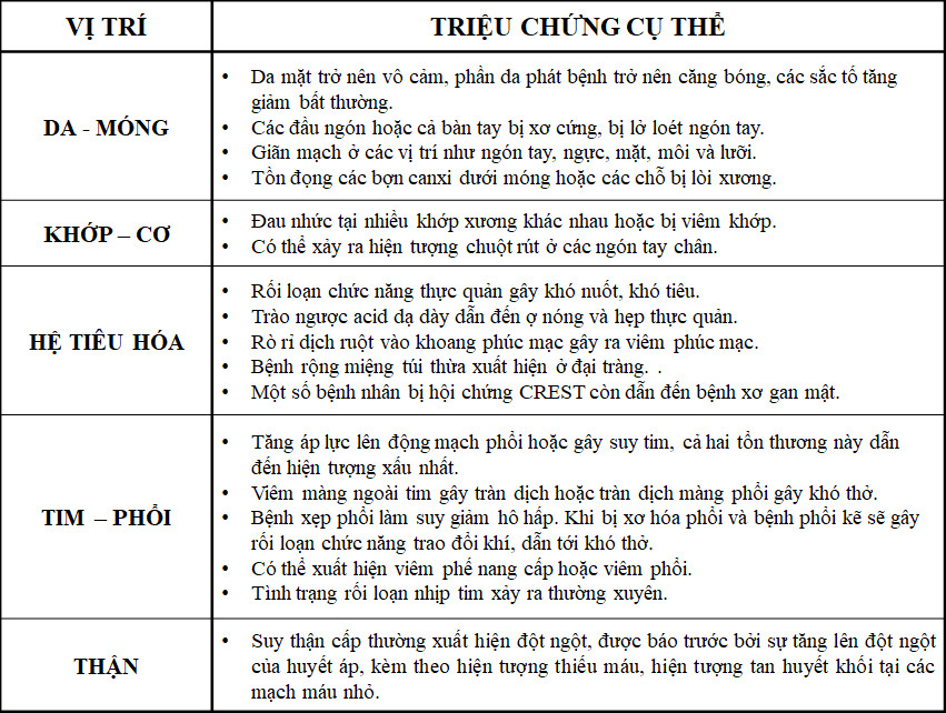 xơ cứng bì sống được bao lau